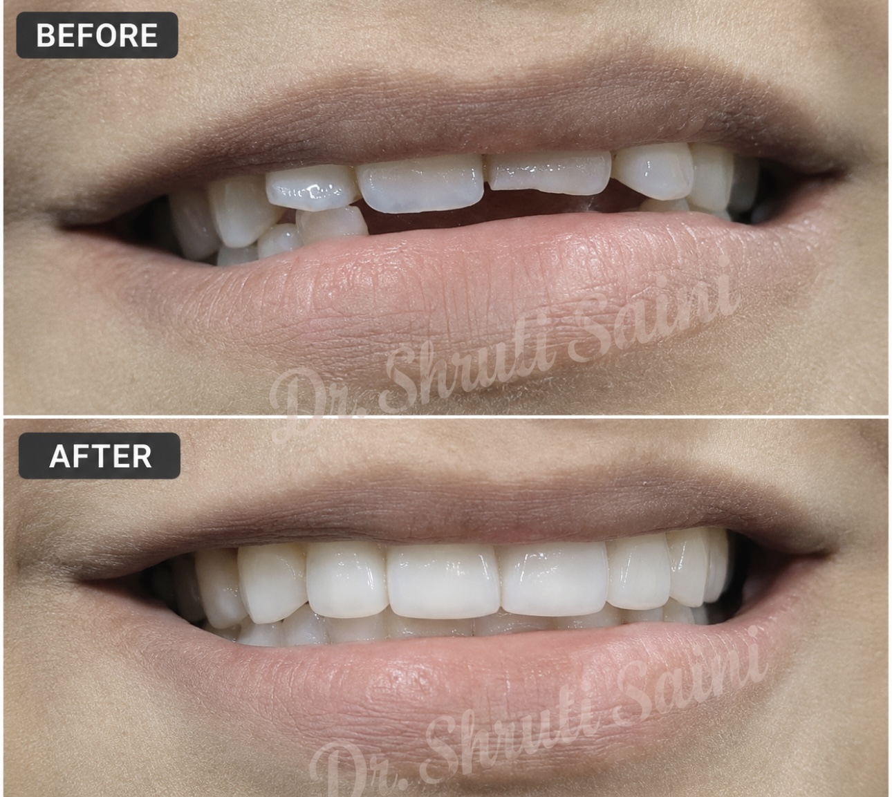 Before & After