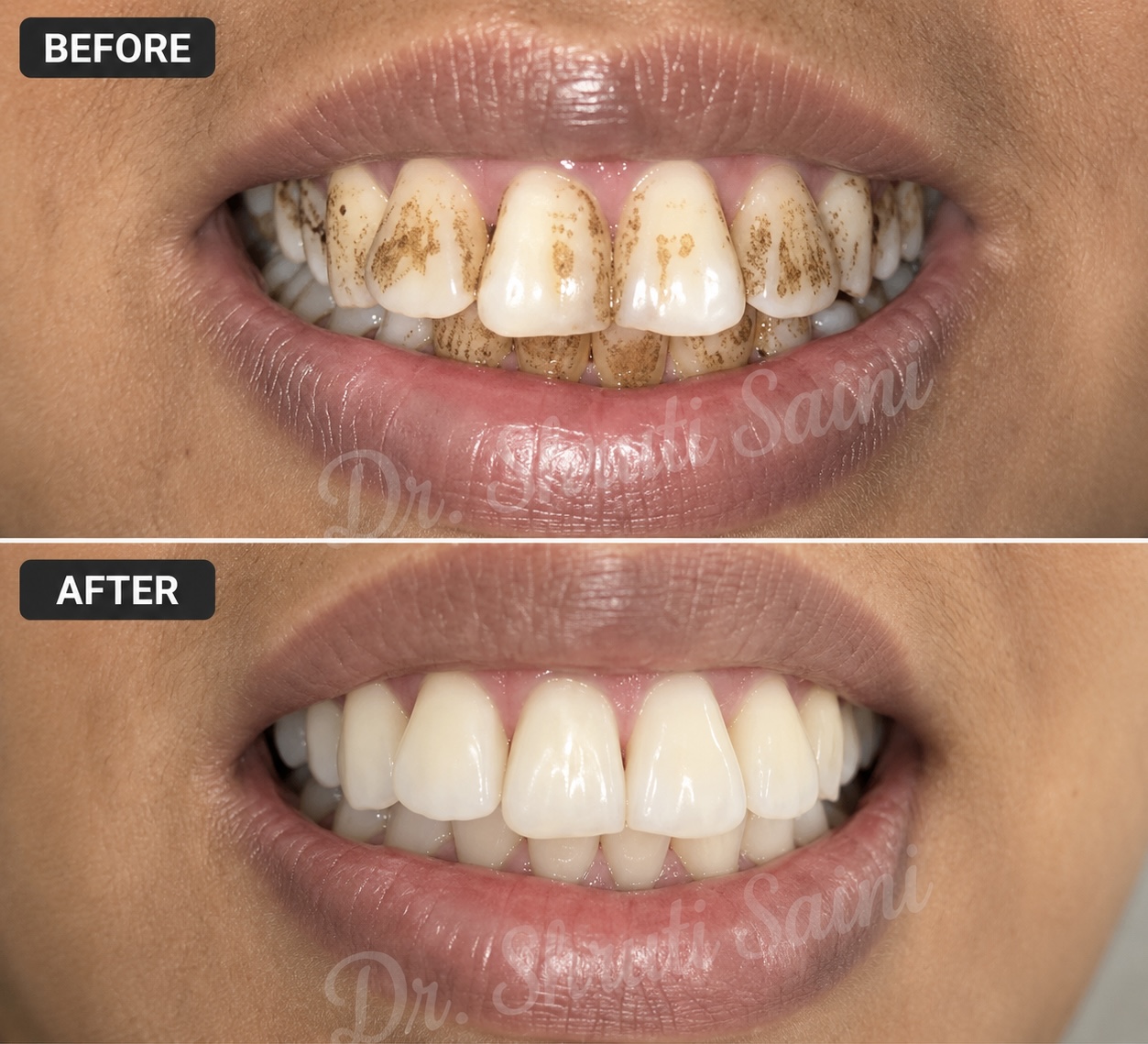 Before & After