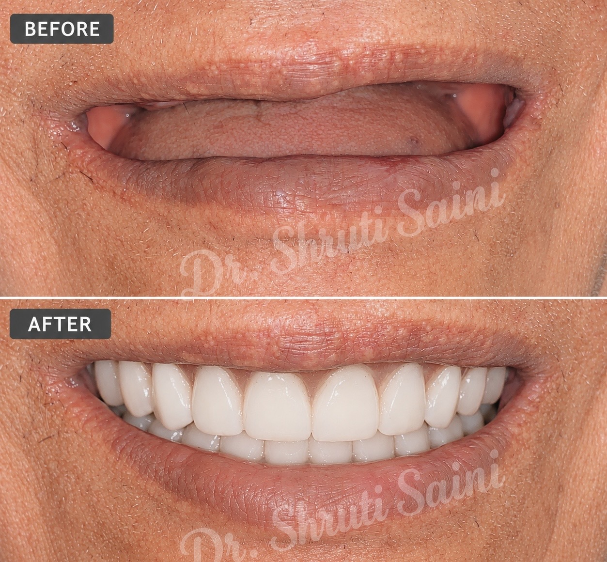 Before & After